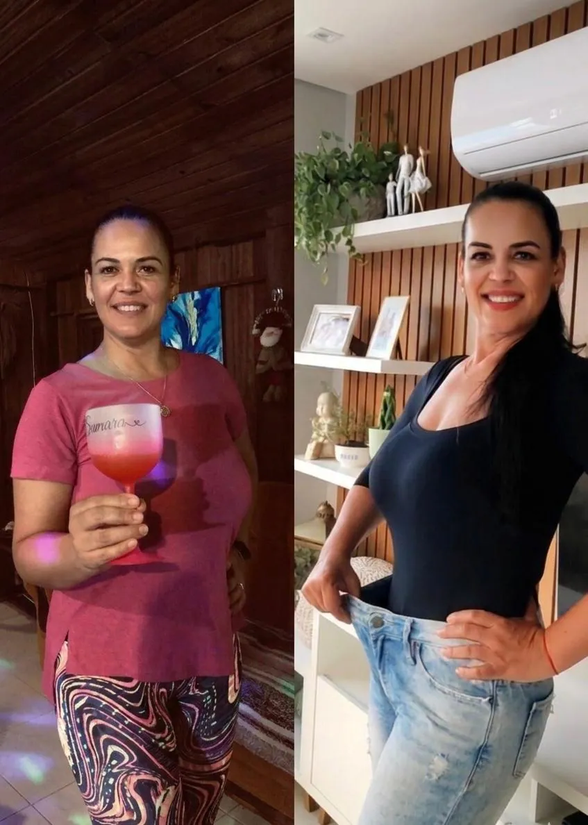 Antes e depois da Samara - Método RM90